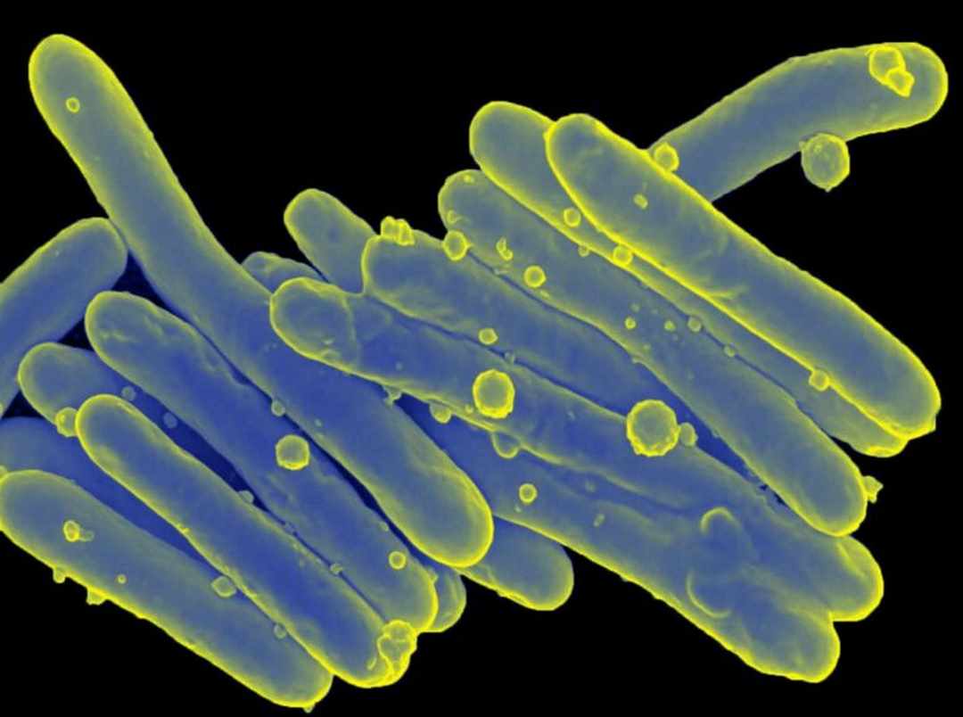 Mycobacterium laprae hay vi khuẩn trực phong