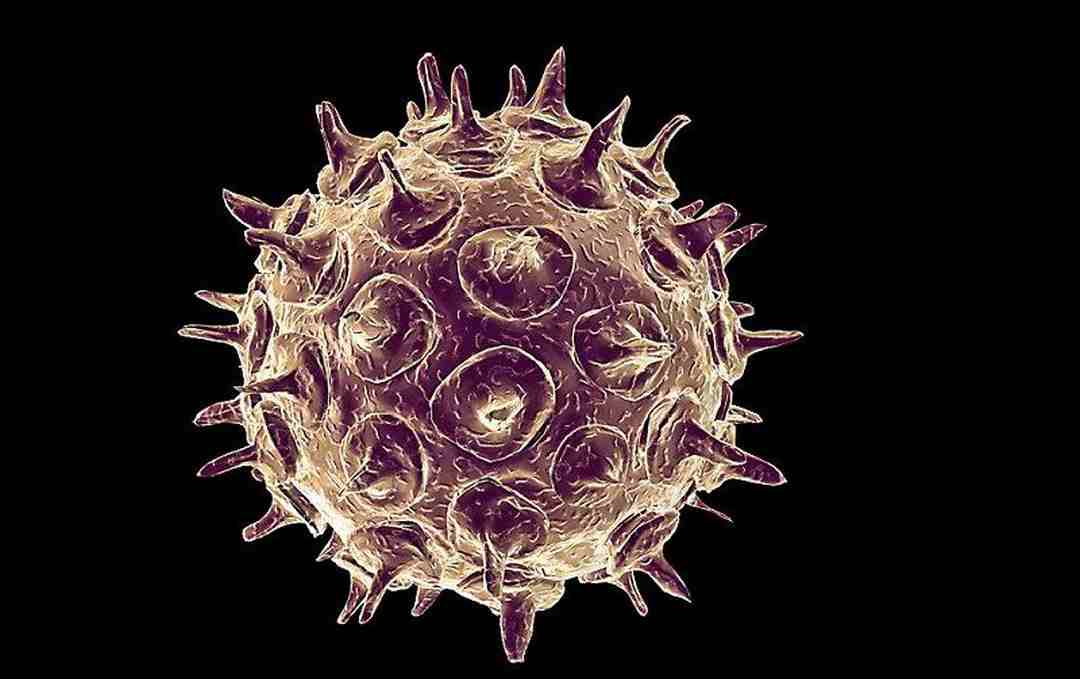 Zona gây ra bởi virus có tên là VZV, môi trường thuận lợi sẽ phát triển