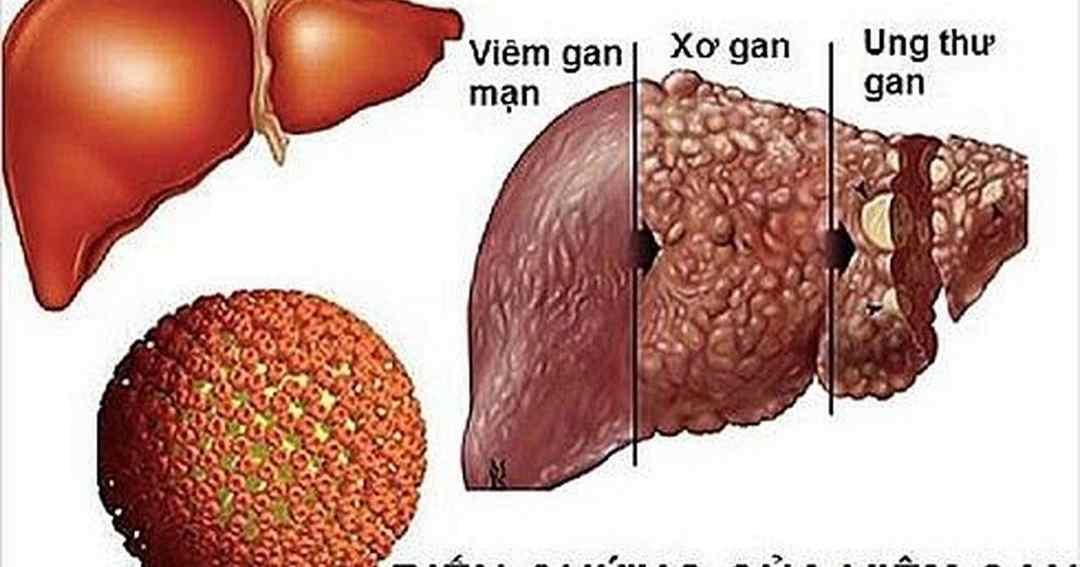 Một số triệu chứng bệnh cần chú ý