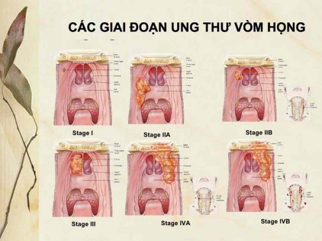 Phương pháp phòng ngừa UTVH hiệu quả