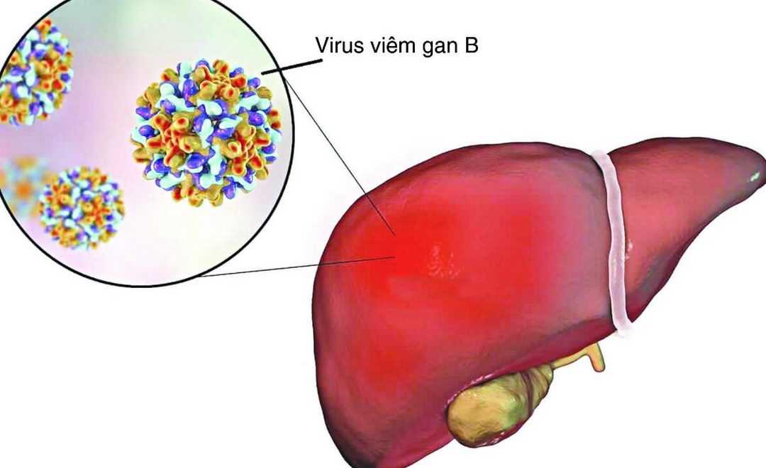 Những ai có thể bị ung thư gan?