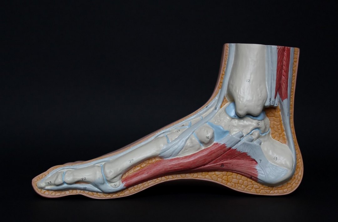 Sarcoma xương là loại thường thấy nhất ở ung thư xương ở thiếu niên