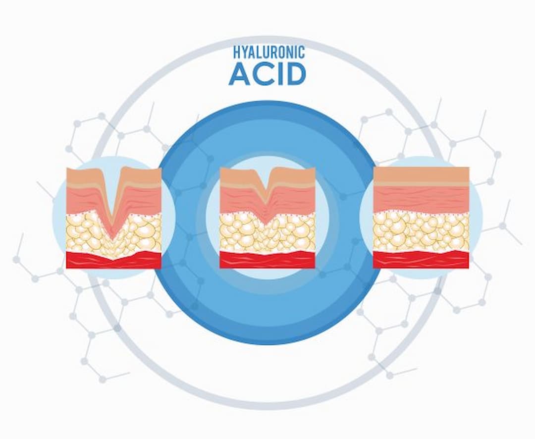 Hyaluronic acid là chất dưỡng ẩm tuyệt vời trong các sản phẩm dưỡng da