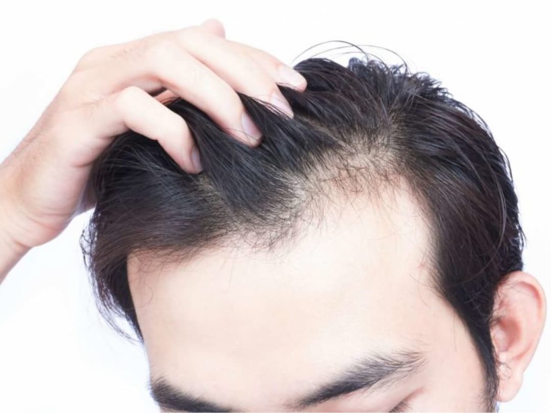 Cách làm tóc nhanh dài cho nam